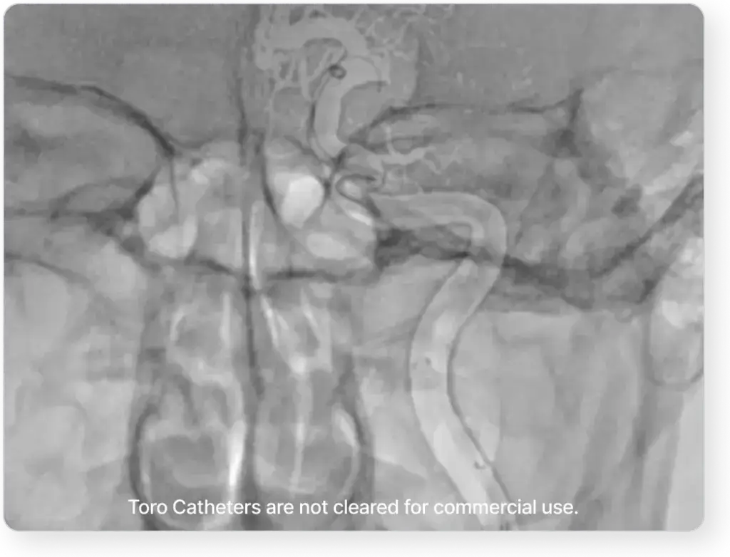 Position matters Featured Image